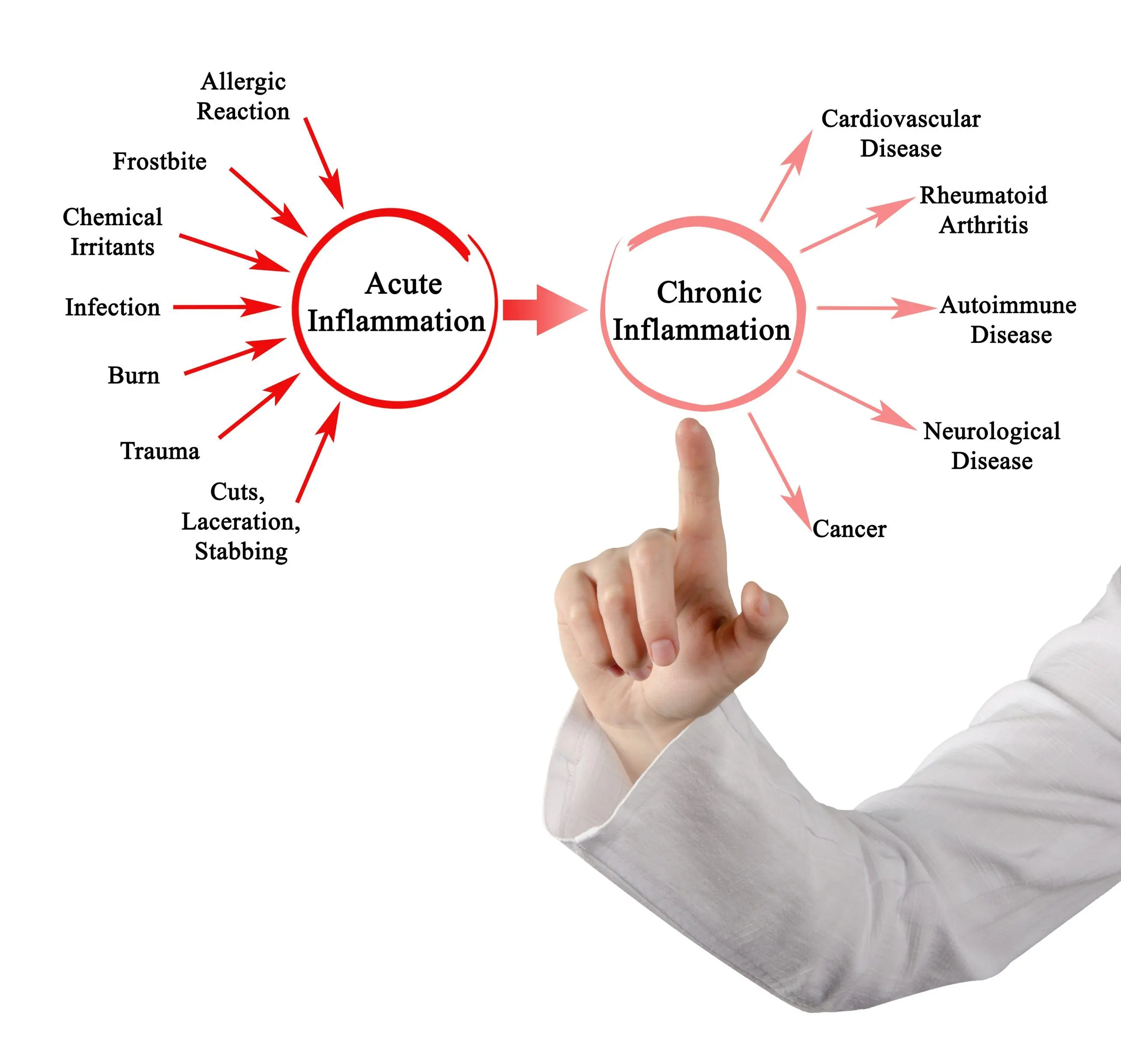 Got Inflammation? See Your Chiropractor